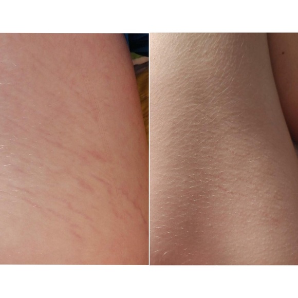 Meet your Posher, MB Distributor, LLC - Picture 9 of 17